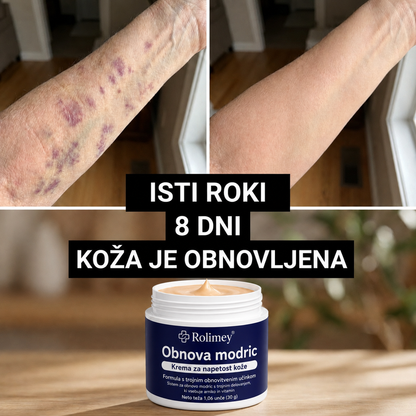 🏆100K+ PRODAJ 💁‍♀️ – Rolimey® Krema za obnovo modric in krepitev kože