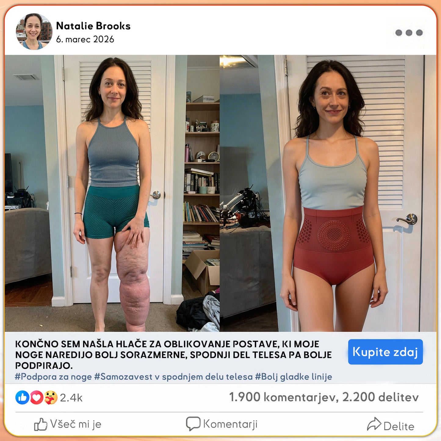🍈Tienda oficial de la marca | 🥬GFOUK® 2026 MORINGA Y BERBERINA 4 EN 1 ESCULTURA DE MICRO-PARTÍCULAS Y PANTALONES CORTOS QUEMAGRASAS✅
