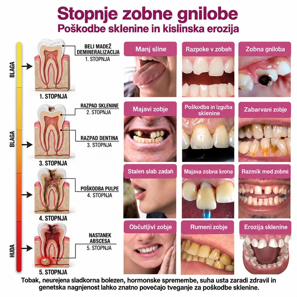 ⚡𝐓𝐫𝐢𝐥𝐮𝐦𝐢𝐚® 𝐃𝐞𝐧𝐏𝐞𝐫𝐦 🦷 – 𝐆𝐞𝐥 𝐳𝐚 𝐨𝐛𝐧𝐨𝐯𝐨 𝐳𝐨𝐛𝐧𝐞 𝐬𝐤𝐥𝐞𝐧𝐢𝐧𝐞 𝐢𝐧 𝐧𝐚𝐫𝐚𝐯𝐧𝐨 𝐫𝐞𝐦𝐢𝐧𝐞𝐫𝐚𝐥𝐢𝐳𝐚𝐜𝐢𝐣𝐨 𝐳𝐨𝐛 🛡️