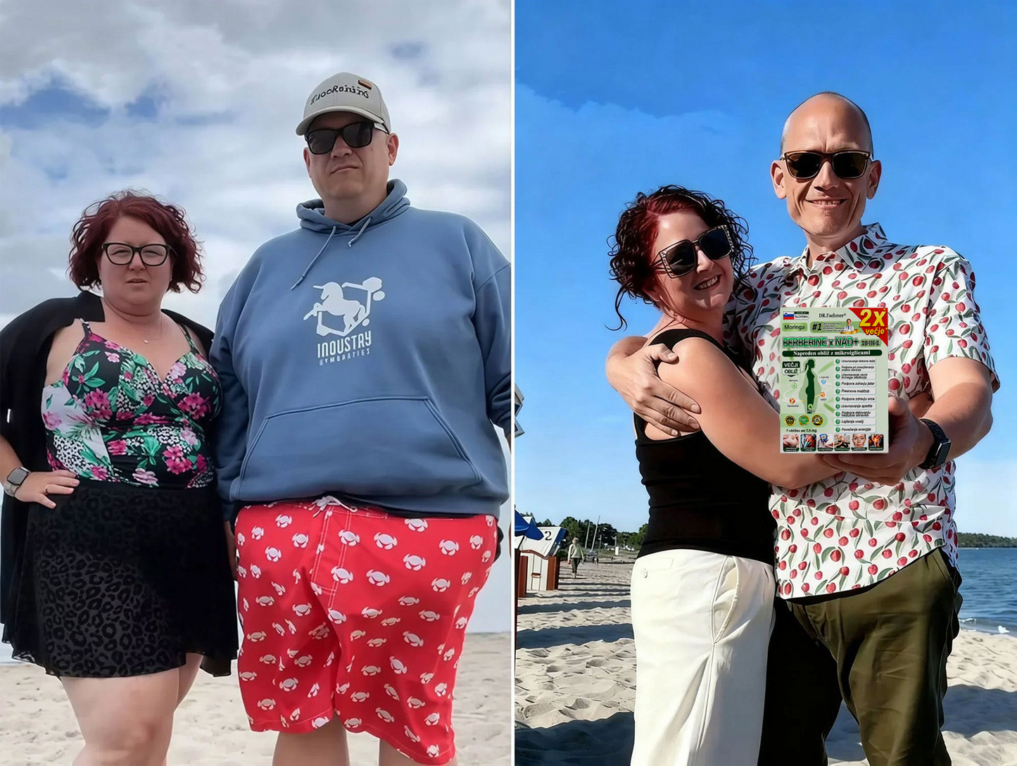 💥DR.Fachmer® Moringa Berberine NAD+ 15-v-1 obliž z nano-mikroiglami | Nova generacija nege telesa z napredno nano formulo 💥