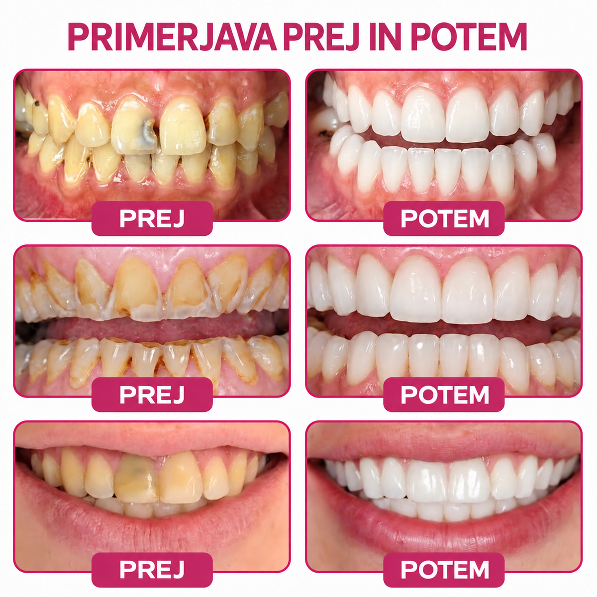 ⚡𝐓𝐫𝐢𝐥𝐮𝐦𝐢𝐚® 𝐃𝐞𝐧𝐏𝐞𝐫𝐦 🦷 – 𝐆𝐞𝐥 𝐳𝐚 𝐨𝐛𝐧𝐨𝐯𝐨 𝐳𝐨𝐛𝐧𝐞 𝐬𝐤𝐥𝐞𝐧𝐢𝐧𝐞 𝐢𝐧 𝐧𝐚𝐫𝐚𝐯𝐧𝐨 𝐫𝐞𝐦𝐢𝐧𝐞𝐫𝐚𝐥𝐢𝐳𝐚𝐜𝐢𝐣𝐨 𝐳𝐨𝐛 🛡️