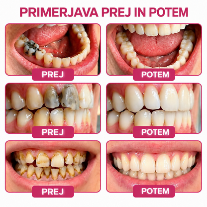 ⚡𝐓𝐫𝐢𝐥𝐮𝐦𝐢𝐚® 𝐃𝐞𝐧𝐏𝐞𝐫𝐦 🦷 – 𝐆𝐞𝐥 𝐳𝐚 𝐨𝐛𝐧𝐨𝐯𝐨 𝐳𝐨𝐛𝐧𝐞 𝐬𝐤𝐥𝐞𝐧𝐢𝐧𝐞 𝐢𝐧 𝐧𝐚𝐫𝐚𝐯𝐧𝐨 𝐫𝐞𝐦𝐢𝐧𝐞𝐫𝐚𝐥𝐢𝐳𝐚𝐜𝐢𝐣𝐨 𝐳𝐨𝐛 🛡️