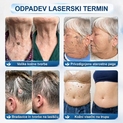 🌿DR.Fachmer®👩‍⚕️ Rezultati so vidni že v 7 dneh! Valjček za odstranjevanje bradavic in drugih kožnih težav | Neboleče in minimalno razmaže. 🌿