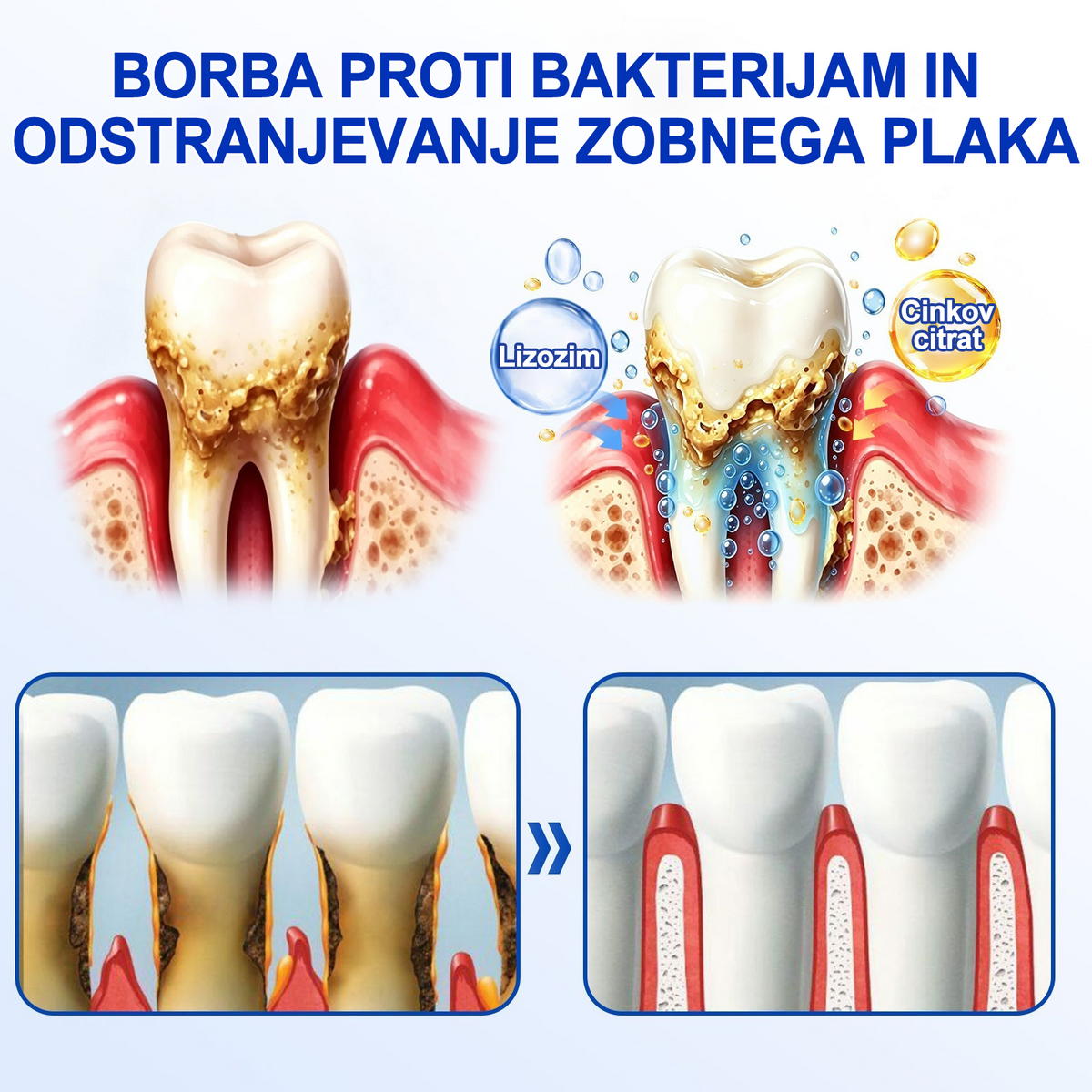 🇸🇮 DR. Fachmer® 🤍 GumRevive parodontalni obnovitveni gel 🤍