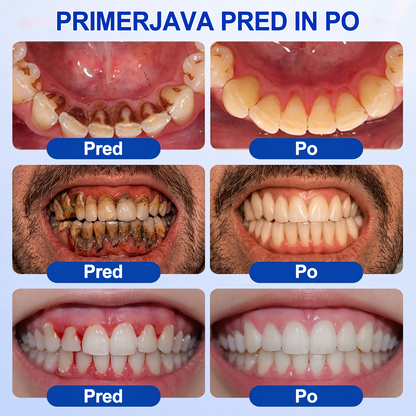 🇸🇮 DR. Fachmer® 🤍 GumRevive parodontalni obnovitveni gel 🤍