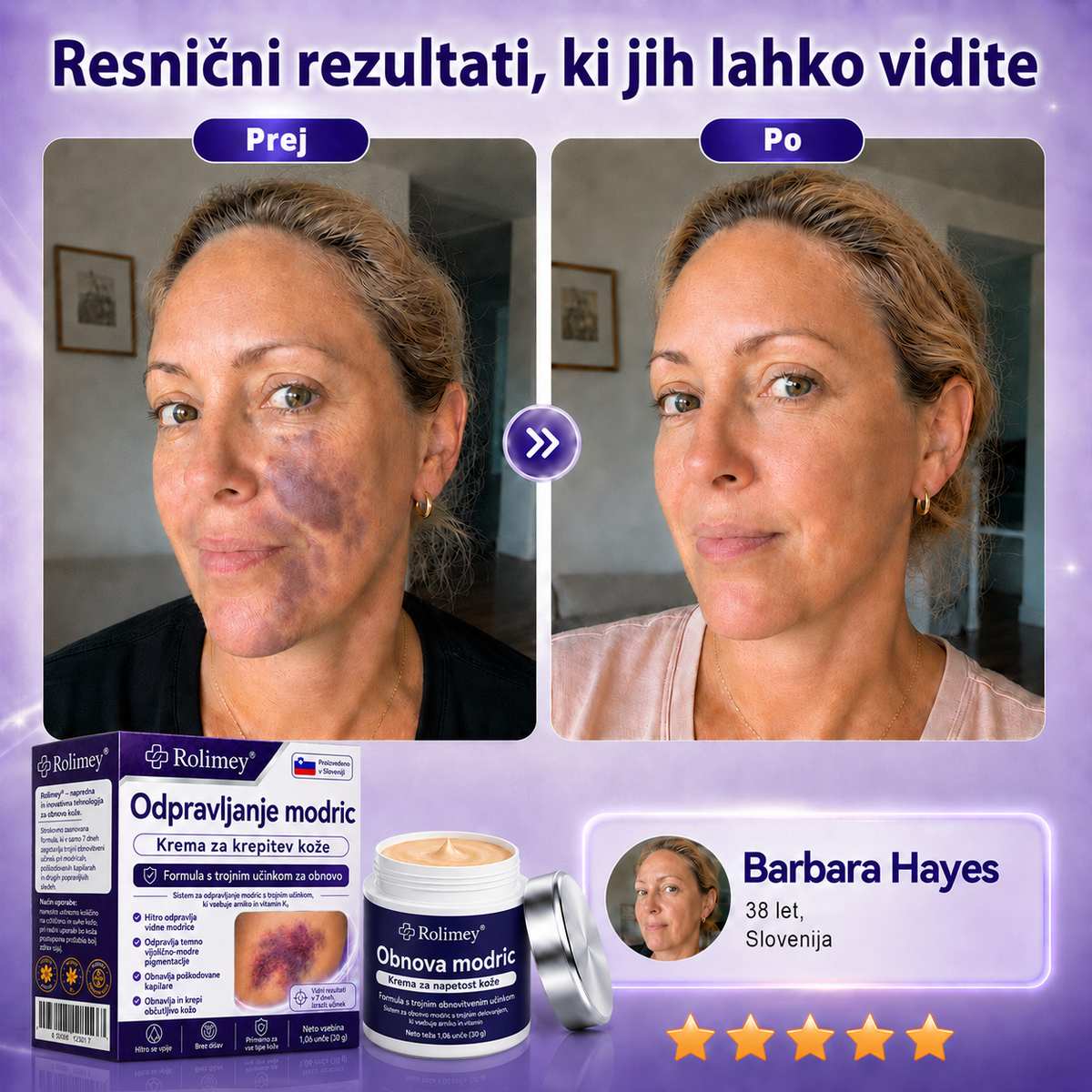 🏆100K+ PRODAJ 💁‍♀️ – Rolimey® Krema za obnovo modric in krepitev kože