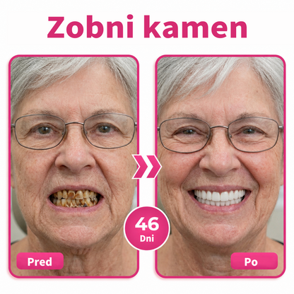💖DR.Fachmer® Thismile NH-10 zobna pasta-serum za zobno sklenino in dlesni – napredna terapija 💖