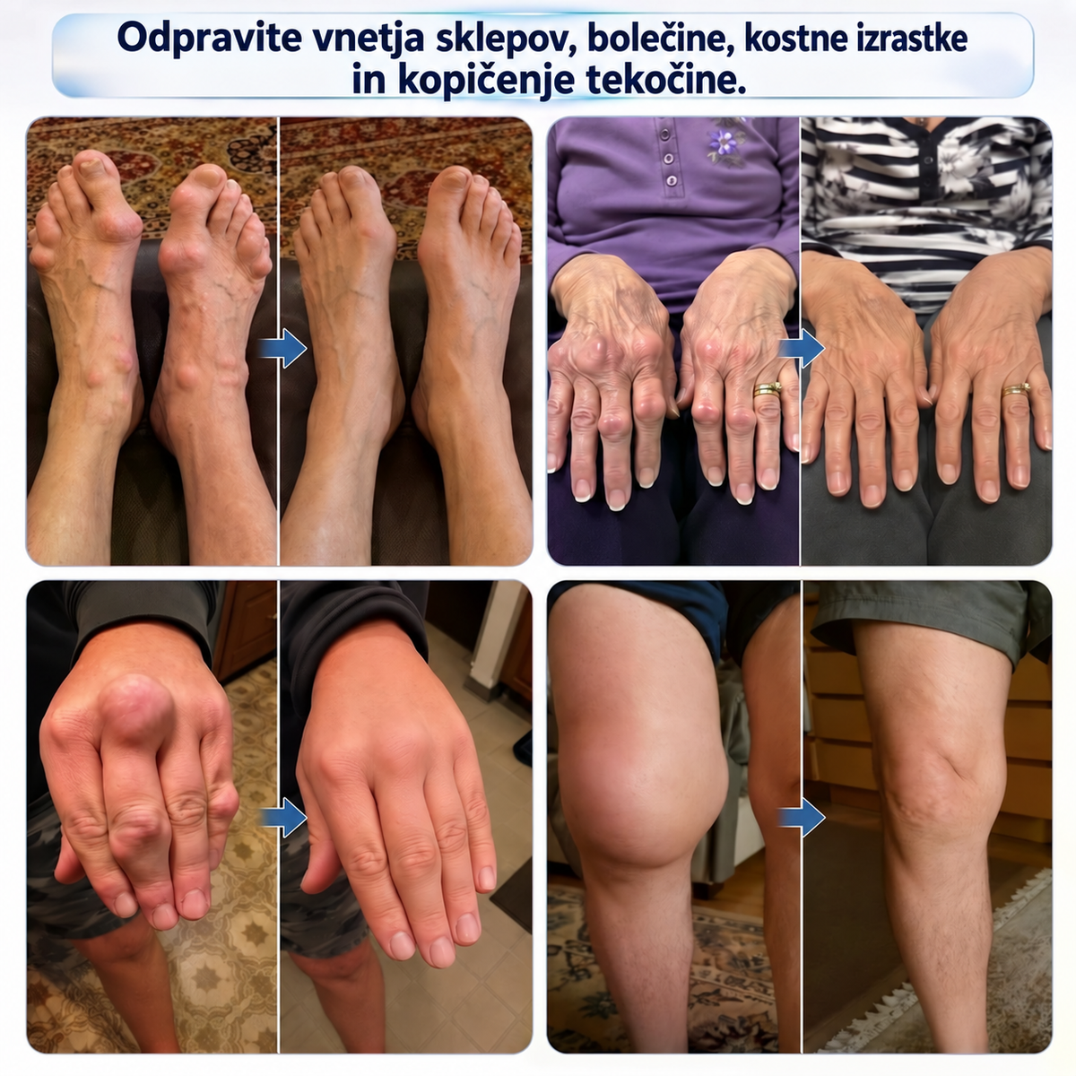 💥💥 DR.Fachmer® Mentol · Arnika · Vražji krempelj 10-v-1 roll-on za nego sklepov in mišic | Pri protinu, togosti sklepov, otekanju in bolečinah v mišicah | Hitro se vpije, ni masten