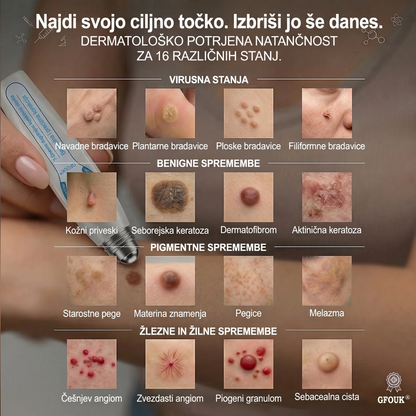 👩🏻‍🔬GFOUK® 7-𝑫𝒏𝒆𝒗𝒏𝒊 𝑶𝒅𝒔𝒕𝒓𝒂𝒏𝒋𝒆𝒗𝒂𝒏𝒋𝒆 𝑷𝒊𝒈𝒎𝒆𝒏𝒕𝒏𝒊𝒉 𝑴𝒂𝒅𝒆ž𝒆𝒗 𝑰𝒏 𝑩𝒓𝒂𝒛𝒈𝒐𝒕𝒊𝒏 𝑷𝒊𝒔𝒂𝒍𝒐(𝐵𝑟𝑒𝑧 𝑏𝑜𝑙𝑒č𝑖𝑛𝑒, 𝑏𝑟𝑒𝑧 𝑏𝑟𝑎𝑧𝑔𝑜𝑡𝑖𝑛 – 𝑟𝑜𝑙𝑙𝑒𝑟𝑏𝑎𝑙𝑙)💪