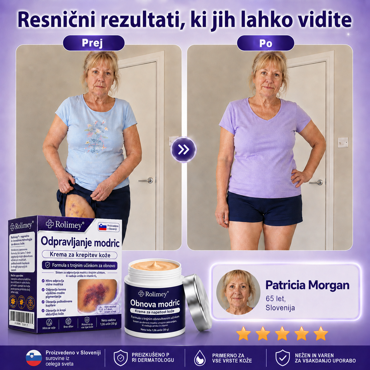 🏆100K+ PRODAJ 💁‍♀️ – Rolimey® Krema za obnovo modric in krepitev kože