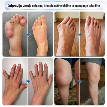 💥💥 DR.Fachmer® Mentol · Arnika · Vražji krempelj 10-v-1 roll-on za nego sklepov in mišic | Pri protinu, togosti sklepov, otekanju in bolečinah v mišicah | Hitro se vpije, ni masten
