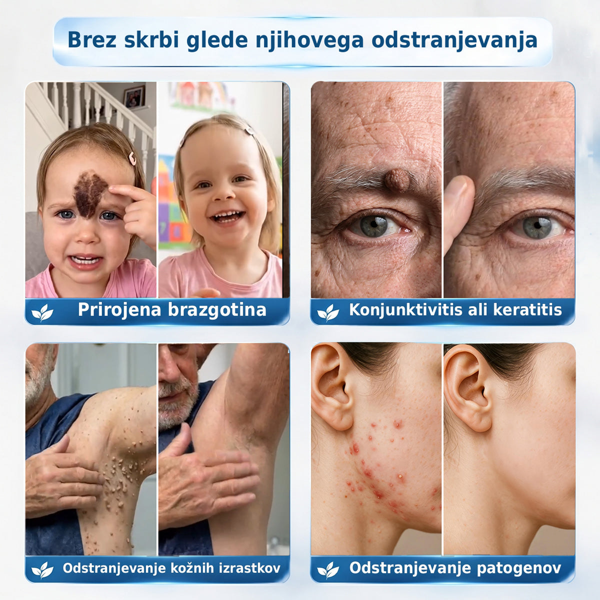 🥇❤️ DR.Fachmer® Napredna Korektivna Krema za Kožne Izrastke, Madeže in Pigmentne Nepravilnosti – 7 Dni Brez Bolečin in Brez Brazgotin – Napredna Nega Kožnih Nepravilnosti