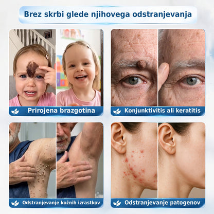 🥇❤️ DR.Fachmer® Napredna Korektivna Krema za Kožne Izrastke, Madeže in Pigmentne Nepravilnosti – 7 Dni Brez Bolečin in Brez Brazgotin – Napredna Nega Kožnih Nepravilnosti