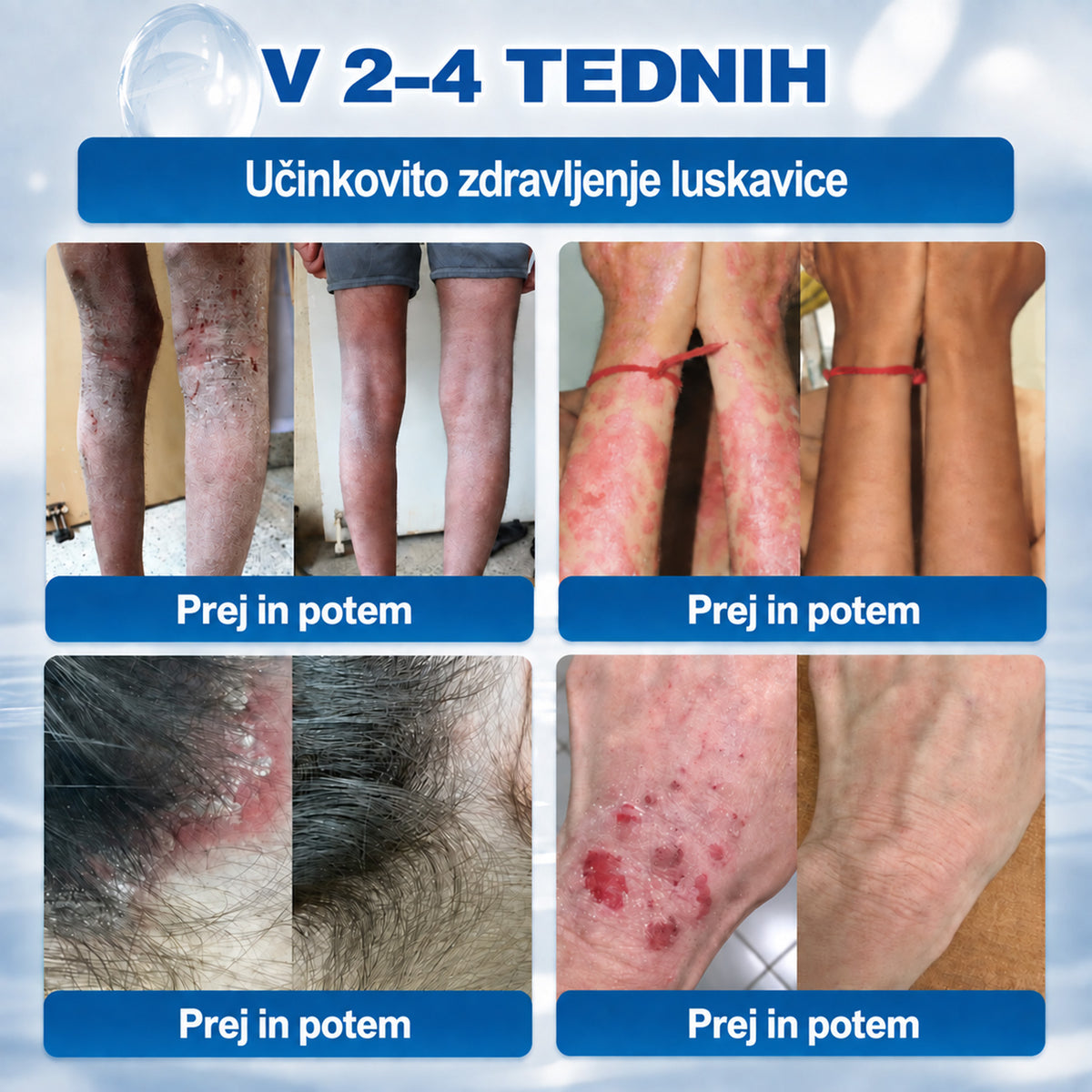 🥇❤️ DR.Fachmer® Napredna Korektivna Krema za Kožne Izrastke, Madeže in Pigmentne Nepravilnosti – 7 Dni Brez Bolečin in Brez Brazgotin – Napredna Nega Kožnih Nepravilnosti