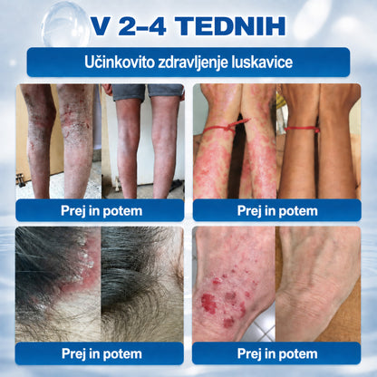 🥇❤️ DR.Fachmer® Napredna Korektivna Krema za Kožne Izrastke, Madeže in Pigmentne Nepravilnosti – 7 Dni Brez Bolečin in Brez Brazgotin – Napredna Nega Kožnih Nepravilnosti