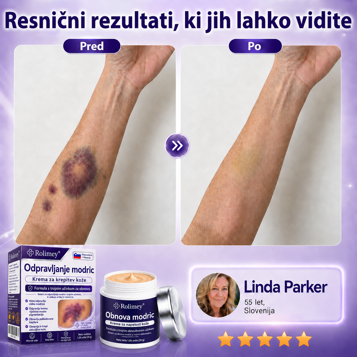 🏆100K+ PRODAJ 💁‍♀️ – Rolimey® Krema za obnovo modric in krepitev kože