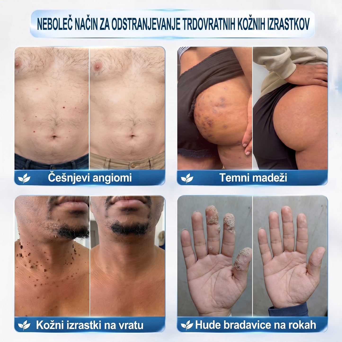 👩🏻‍🔬GFOUK® 7-𝑫𝒏𝒆𝒗𝒏𝒊 𝑶𝒅𝒔𝒕𝒓𝒂𝒏𝒋𝒆𝒗𝒂𝒏𝒋𝒆 𝑷𝒊𝒈𝒎𝒆𝒏𝒕𝒏𝒊𝒉 𝑴𝒂𝒅𝒆ž𝒆𝒗 𝑰𝒏 𝑩𝒓𝒂𝒛𝒈𝒐𝒕𝒊𝒏 𝑷𝒊𝒔𝒂𝒍𝒐(𝐵𝑟𝑒𝑧 𝑏𝑜𝑙𝑒č𝑖𝑛𝑒, 𝑏𝑟𝑒𝑧 𝑏𝑟𝑎𝑧𝑔𝑜𝑡𝑖𝑛 – 𝑟𝑜𝑙𝑙𝑒𝑟𝑏𝑎𝑙𝑙)💪