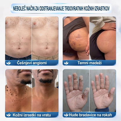 👩🏻‍🔬GFOUK® 7-𝑫𝒏𝒆𝒗𝒏𝒊 𝑶𝒅𝒔𝒕𝒓𝒂𝒏𝒋𝒆𝒗𝒂𝒏𝒋𝒆 𝑷𝒊𝒈𝒎𝒆𝒏𝒕𝒏𝒊𝒉 𝑴𝒂𝒅𝒆ž𝒆𝒗 𝑰𝒏 𝑩𝒓𝒂𝒛𝒈𝒐𝒕𝒊𝒏 𝑷𝒊𝒔𝒂𝒍𝒐(𝐵𝑟𝑒𝑧 𝑏𝑜𝑙𝑒č𝑖𝑛𝑒, 𝑏𝑟𝑒𝑧 𝑏𝑟𝑎𝑧𝑔𝑜𝑡𝑖𝑛 – 𝑟𝑜𝑙𝑙𝑒𝑟𝑏𝑎𝑙𝑙)💪
