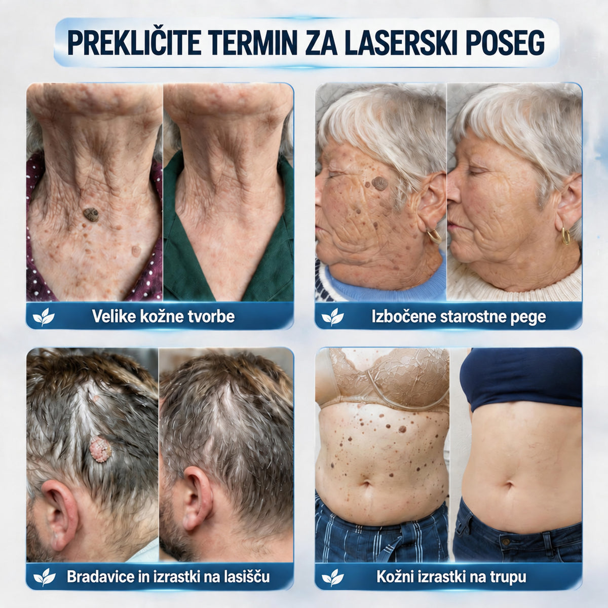 🥇❤️ DR.Fachmer® Napredna Korektivna Krema za Kožne Izrastke, Madeže in Pigmentne Nepravilnosti – 7 Dni Brez Bolečin in Brez Brazgotin – Napredna Nega Kožnih Nepravilnosti