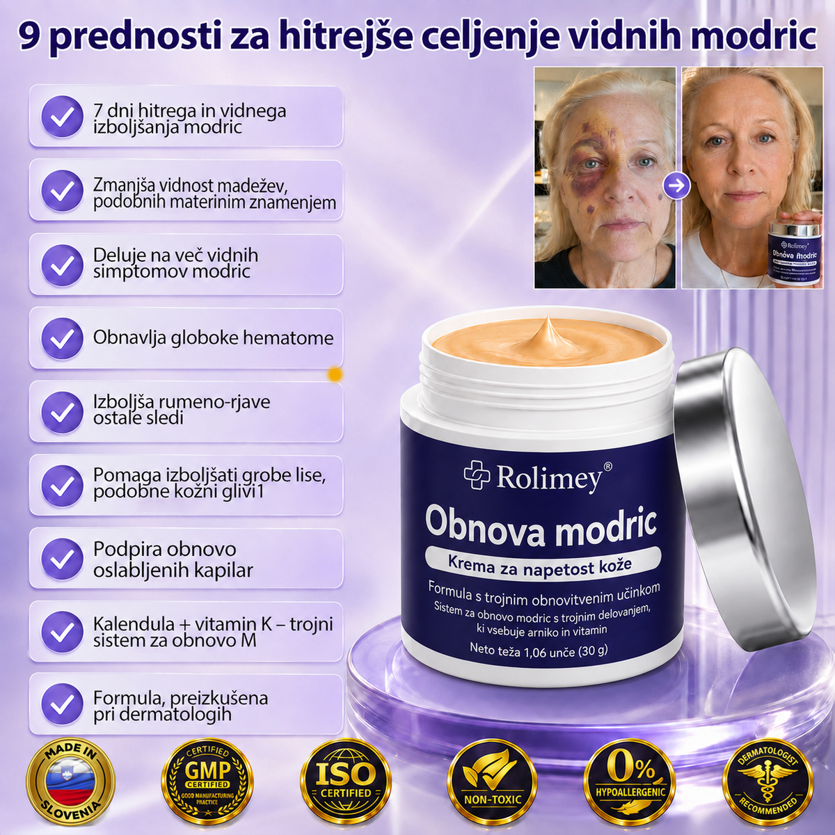 🏆100K+ PRODAJ 💁‍♀️ – Rolimey® Krema za obnovo modric in krepitev kože