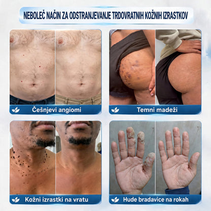 🥇❤️ DR.Fachmer® Napredna Korektivna Krema za Kožne Izrastke, Madeže in Pigmentne Nepravilnosti – 7 Dni Brez Bolečin in Brez Brazgotin – Napredna Nega Kožnih Nepravilnosti