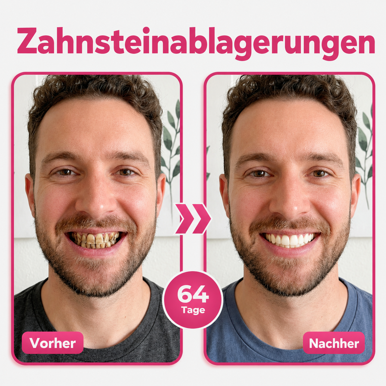 DR.Fachmer® Thismile NH-10 zobna pasta-serum za zobno sklenino in dlesni – napredna terapija