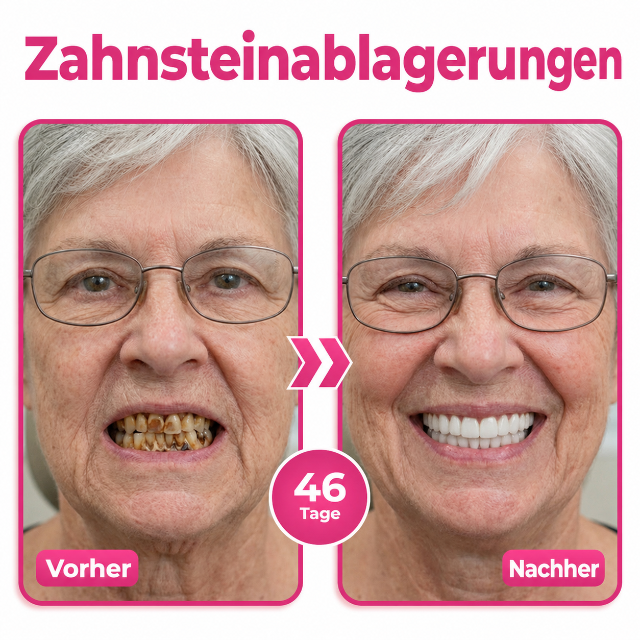DR.Fachmer® Thismile NH-10 zobna pasta-serum za zobno sklenino in dlesni – napredna terapija