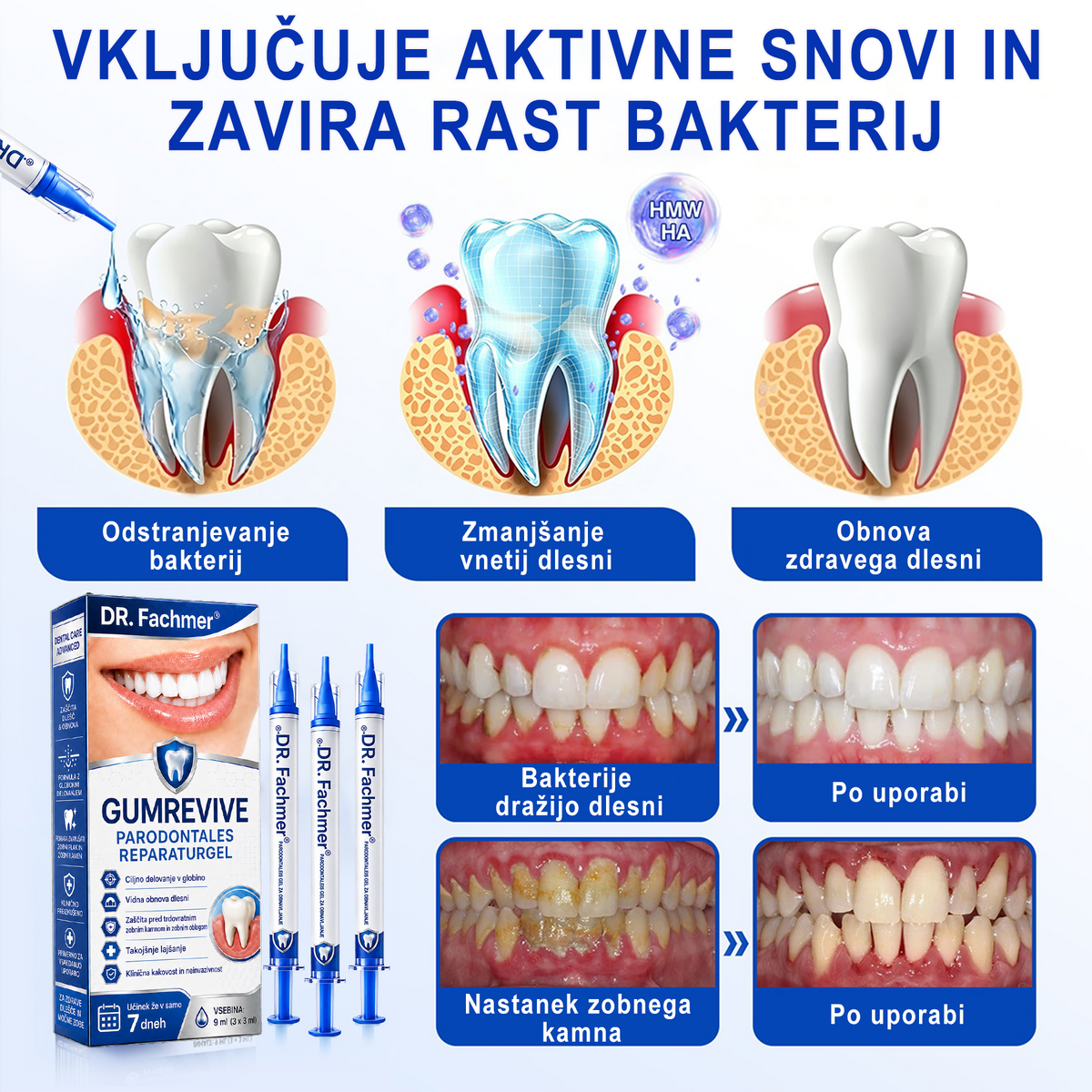 🇸🇮 DR. Fachmer® 🤍 GumRevive parodontalni obnovitveni gel 🤍