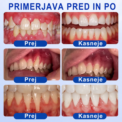 🇸🇮 DR. Fachmer® 🤍 GumRevive parodontalni obnovitveni gel 🤍